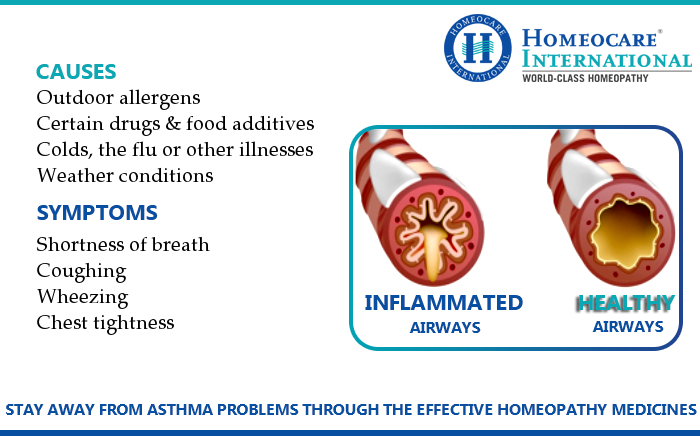 Asthma-through-Homeopathic-Treatment