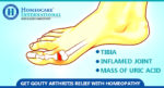 New approaches to treat Gouty Arthritis at Homeocare International without any side effects
