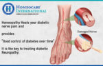 Get Safe Treatment for Diabetic Neuropathy at Homeocare International