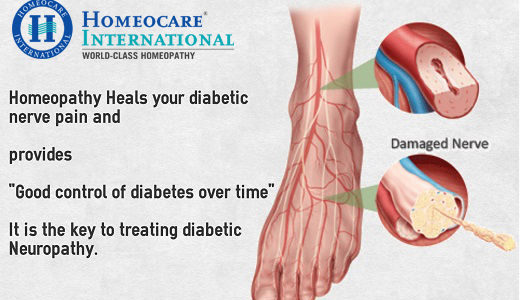 Get Safe Treatment for Diabetic Neuropathy at Homeocare International