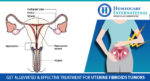 Homeocare International doctors cures Uterine fibroids without surgical treatment
