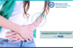 Natural Homeopathy Treatment for Polycystic Ovary Syndrome (PCOS)
