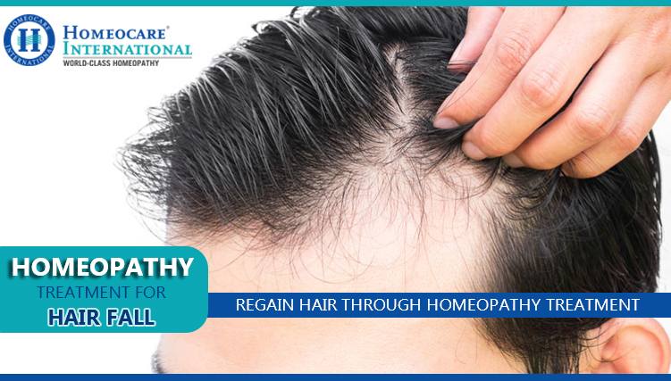 10 remarkable homeopathy medicines for Hair fall control regrowth   Homeomart