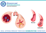Heal Asthma disease through Homeopathic Medicines