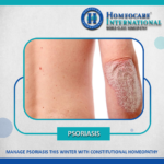 Overcome Psoriasis with Alternative Homeopathy Treatment