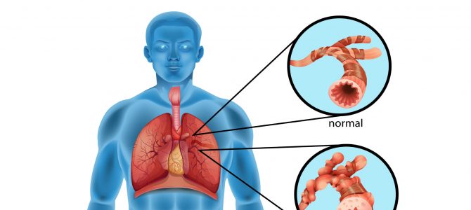 Homeopathy Treatment for Asthma Disorder