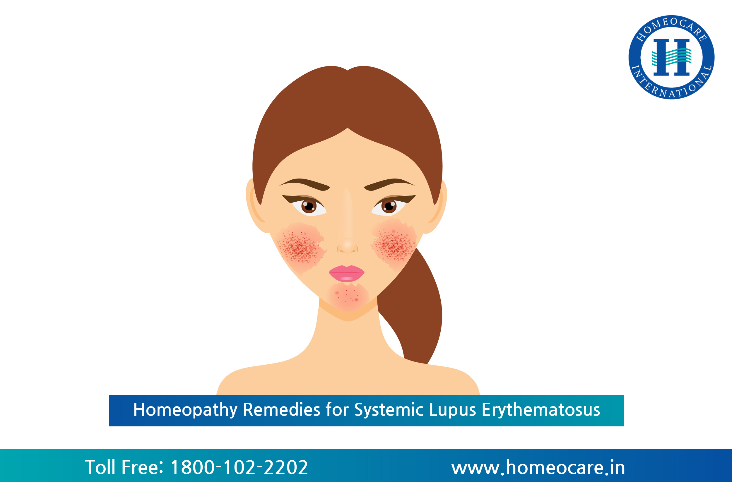 Homeopathic Remedies for Systemic Lupus Erythematosus