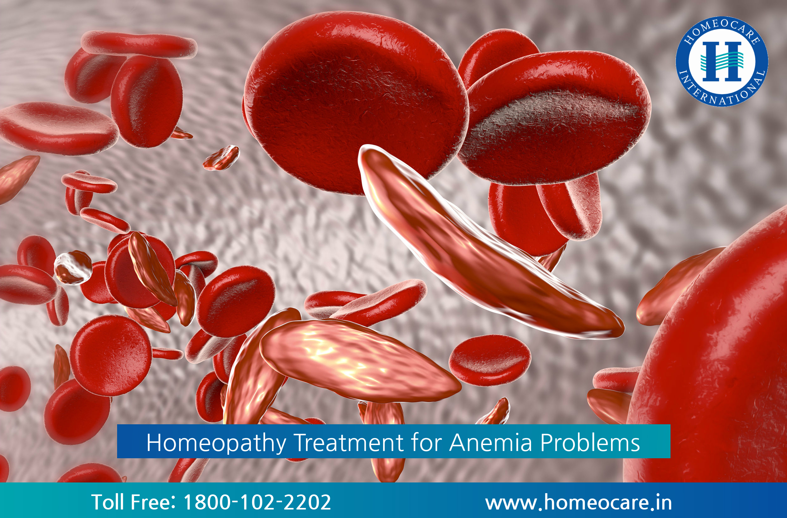 Homeopathy Treatment for Anemia Problems