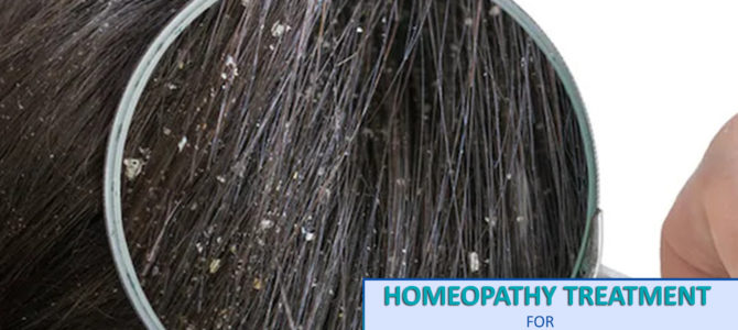 Get Rid of Dandruff this winter with Homeopathy @Homeocare International