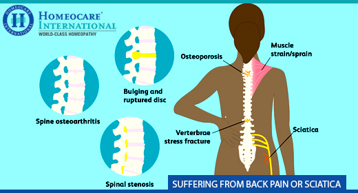 Get relief from Sciatica with Genetic Constitutional Homeopathy treatment at Homeocare International