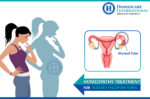 Worried about your blocked Fallopian tubes? Treat them with Homeopathy