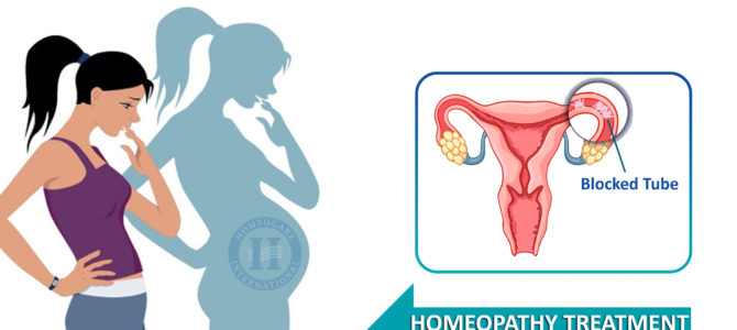Worried about your blocked Fallopian tubes? Treat them with Homeopathy