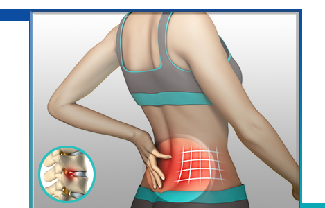 Ease your slipped disc problem effectively with Homeopathy