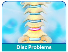 disc-problems